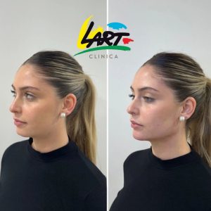Estética facial y armonización en Clínica Lart, Valdivia