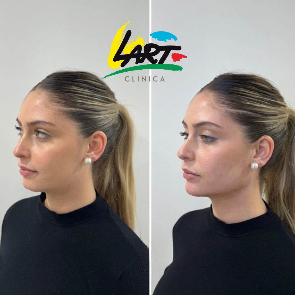 Estética facial y armonización en Clínica Lart, Valdivia